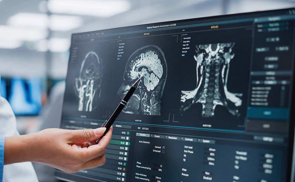 Resultado de exame para analise de aneurisma