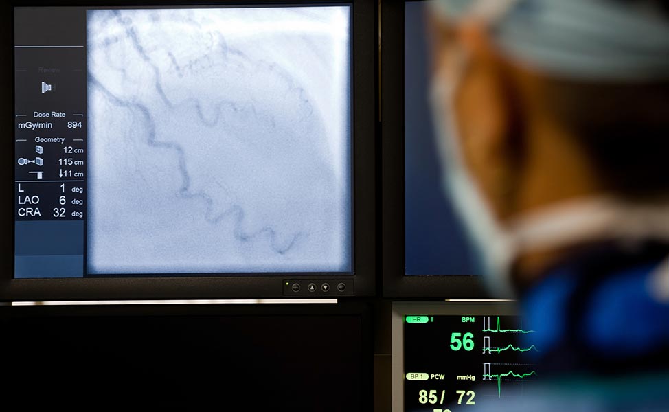 Médico observando angiografia
